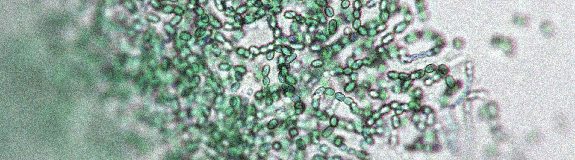 There is a relationship between gut microbiota and physical activity