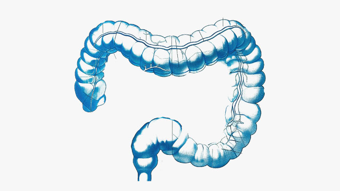 Colite et traitements pour l’intestin