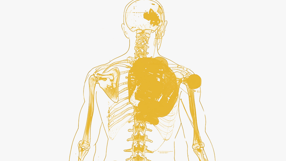 Femme qui souffre d'inflammation chronique et de douleurs