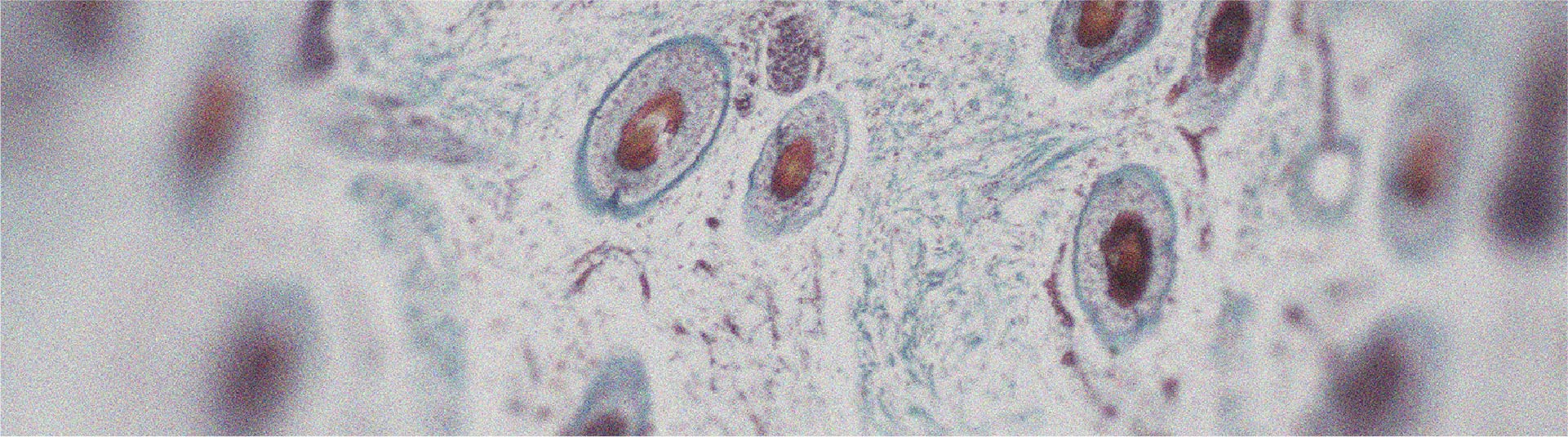 In what ways can vitamin A be good for the skin?